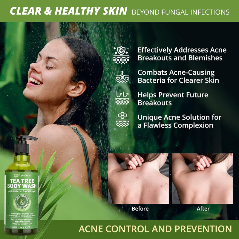 Roycederm Tea Tree Care Bundle: Antifungal Body Wash & Scalp Relief Spray Infinity Warehouse