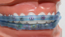 Element Braces Comfort Lip Bumper (Blue) - Orthodontic - Dental ELEMENT