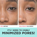 IT Cosmetics Bye Bye Pores 10% Glycolic Acid Serum - Visibly Minimizes Pores In 1 Week & Exfoliates to Help Refine Skin’s Texture - With Hyaluronic Acid - Vegan Formula - 1 fl oz It Cosmetics