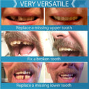 Instant Smile Complete Your Smile Temporary Tooth Replacement Kit - Replace a missing tooth in minutes - Patented Instant Smile Store
