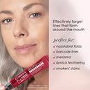 Dermelect Smooth Upper Lip & Perioral Anti-Aging Treatment - Professional Strength 15ml Infinity Warehouse