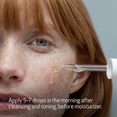 Obagi Professional-C Vitamin C Serum – Helps Brighten Skin Tone and Minimize the Appearance of Fine Lines & Wrinkles – Safe for Sensitive Skin Infinity Warehouse