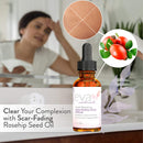 Skin Perfecting Serum – Rosehip Oil + Hyaluronic Acid Serum for Face – Naturally Hydrates, Fades Lines & Wrinkles, Repairs Damaged Skin, Diminishes Blemishes by Eva Naturals, 1 oz. Eva Naturals Store