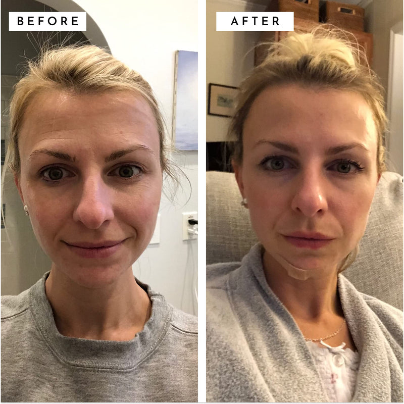 DIME Beauty TBT Anti Aging Facial Serum with Resveratrol, Mandelic Acid and Niacinamide Decrease Fine Lines, Helps Skin Tighten and Hide Wrinkles, Dark Spots and Crows Feet, 1 Count Dime