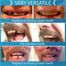 Instant Smile Complete Your Smile Tooth Replacement Kit with 3 Pack Fitting Beads Instant Smile