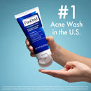 PanOxyl Acne Foaming Wash Benzoyl Peroxide 10% Maximum Strength Antimicrobial, 5.5 oz.(2 Pack Bundle) PanOxyl