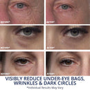 Plexaderm Rapid Reduction Serum - New Single Use Pods - Age-Defying Eye Treatment - Reduce the Look of Under-Eye Bags & Wrinkles, Diminish the Appearance of Dark Circles, Fine Lines & Crow’s Feet Plexaderm