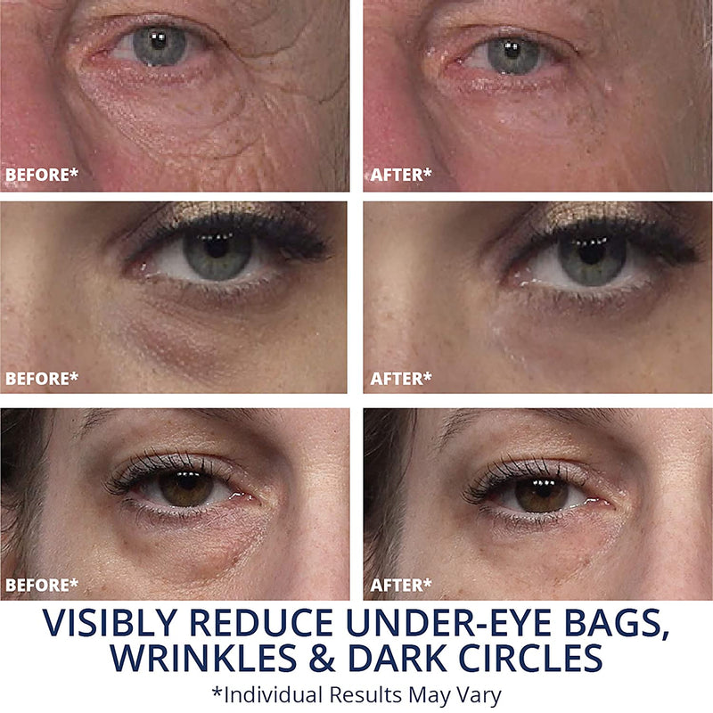 Plexaderm Rapid Reduction Serum - New Single Use Pods - Age-Defying Eye Treatment - Reduce the Look of Under-Eye Bags & Wrinkles, Diminish the Appearance of Dark Circles, Fine Lines & Crow’s Feet Plexaderm