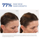 BosleyMD Women's 2% Minoxidil Treatement for Hair Loss and Hair Regrowth, Extra Strength Topical Solution, 2 fl oz (2 Pack) martinandmark.com