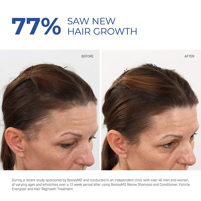 BosleyMD Women's 2% Minoxidil Treatement for Hair Loss and Hair Regrowth, Extra Strength Topical Solution, 2 fl oz (2 Pack) martinandmark.com