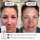 Seranova - Micro Infusion for Skin Care – with Collagen Peptides & Hyaluronic Acid, Face Serum and Stamp 0.05mm - 3 Month Supply Infinity Warehouse