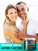 Activated Charcoal Teeth Whitening Powder – Coconut Teeth Whitener – Effective Remover Tooth Stains for a Healthier Whiter Smile - Product of UK by Sunatoria - Improved Formula - Charcoal Teeth White SUNATORIA
