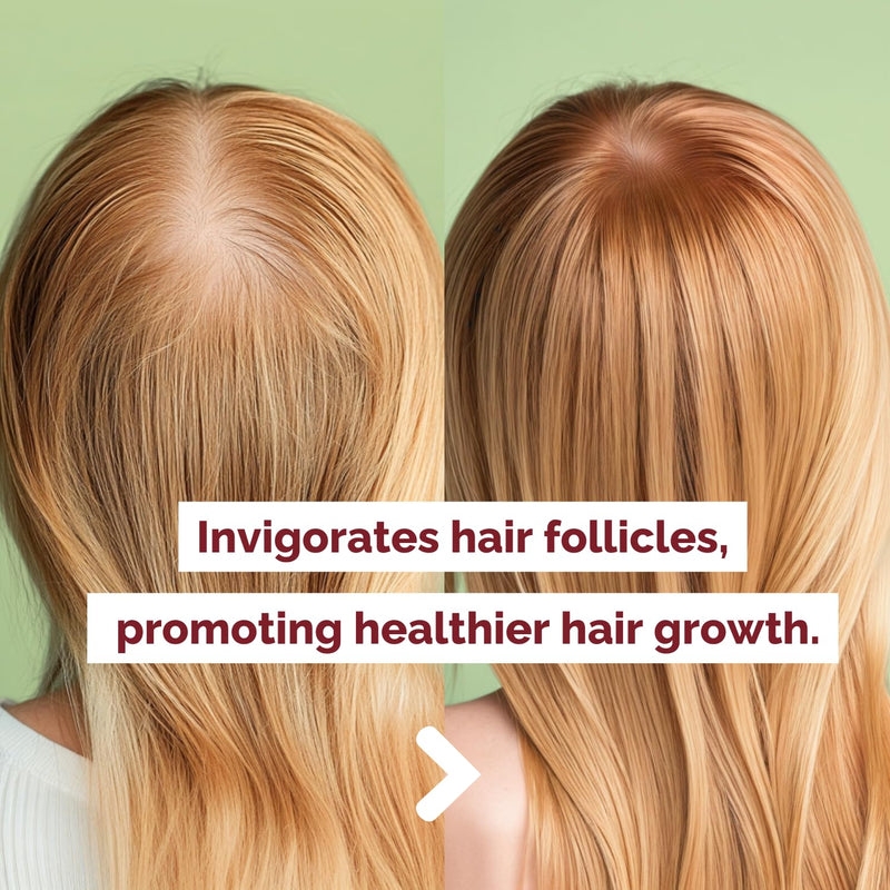 Just Nutritive Onion & Rosemary Shampoo for Hair Growth, Thickening, Strengthening - Sulfate-Free, Enriched with Red Onion Oil, Rosemary Oil, Tea Tree - 16 oz Infinity Warehouse