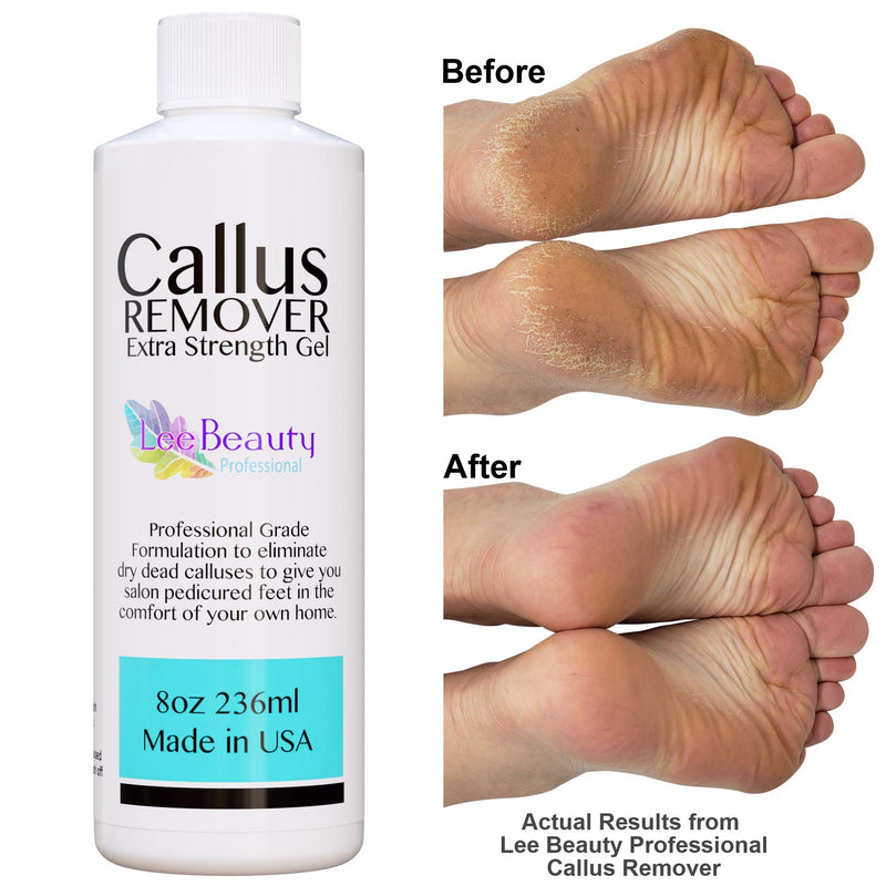 Lee Beauty Professional Callus Remover Extra Strength Gel for Feet, at Home Pedicure Results, 8 Oz LeeBeauty Professional