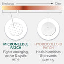Rael Miracle Bundle - Invisible Spot Cover (96 Count) & Microcrystal Spot Cover (9 Count) Rael
