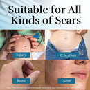 Advanced Scar Cream, Scar Reduction Treatment for Improves Skin Texture & Helps Remove Acne, Surgery, C Section, Burn, Keloid & Hypertrophic Scars 1.76 Oz (50g) Infinity Warehouse