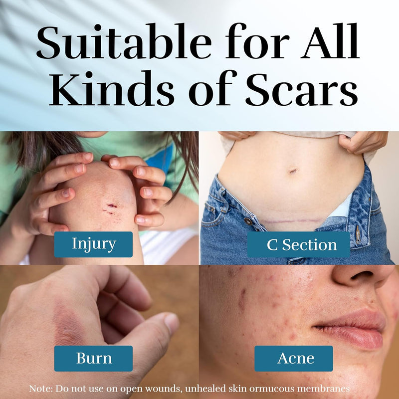 Advanced Scar Cream, Scar Reduction Treatment for Improves Skin Texture & Helps Remove Acne, Surgery, C Section, Burn, Keloid & Hypertrophic Scars 1.76 Oz (50g) Infinity Warehouse