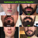 Beard Growth Kit - Complete Beard Grooming Kit for Men with Titanium Microneedle Beard Roller, Natural Beard Oil, Wash, Balm for Hair Growth & A Wooden Comb, Growth Guide, Travel Pouch, Gifts for Men WILDLINERS