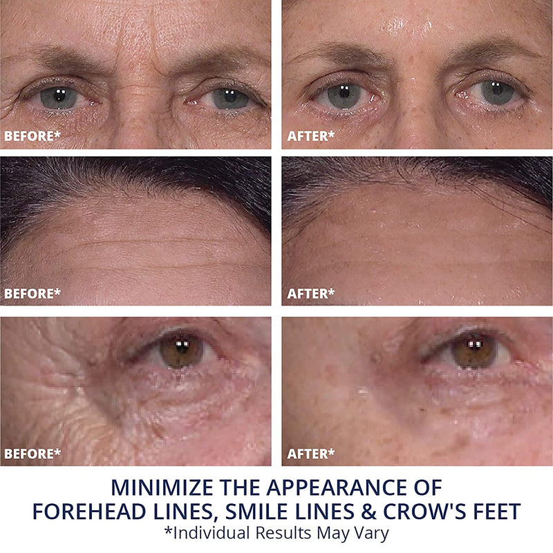 Plexaderm Rapid Reduction Serum - New Single Use Pods - Age-Defying Eye Treatment - Reduce the Look of Under-Eye Bags & Wrinkles, Diminish the Appearance of Dark Circles, Fine Lines & Crow’s Feet Plexaderm