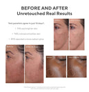 Murad Environmental Shield Rapid Dark Spot Correcting Serum – Daily Dark Spot Serum for Hyperpigmentation - Brightening, Soothing Facial Serum – Dark Spot Corrector, 1.0 Fl Oz Murad