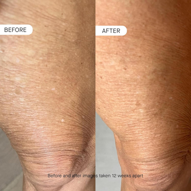 oneskin BODY OS-01 Peptide Skin Longevity Daily Moisturizer- Improves Skin Texture & Barrier, Safe for Sensitive Skin Infinity Warehouse