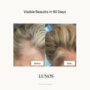 Lunos Grow Hair Growth Supplements - 17 Ingredient Formula with Biotin, Saw Palmetto, & Marine Collagen for Thicker, Fuller Hair - Hair Growth Vitamins for Women & Men Infinity Warehouse