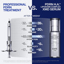 IOPE XMD Stem III Clinical Recovery Serum - Professional PDRN Treatment-Level Results - Visibly Firms, Plumps Volume, and Refines Pores - With Hyaluronic Acid - 1.01 fl. oz. Infinity Warehouse