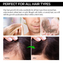 Hair Growth Oil Natural with Caffeine, Biotin and Castor - Hair Growth Oil for Stronger, Thicker, Longer Hair 1.7 oz VigorWell