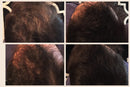 LUXE Hair Thickening Fibers - CONFIDENCE IN A JAR – 2 Months+ Supply! – Hypoallergenic, Dermatologist Tested – Multiple Colors Available (Black) LUXE Professional
