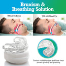 Intelliguard Pro Dental Mouth Guard - Bruxism Nighttime Sleep Mouthguard for Grinding Teeth - Night Guard for Clenching & Gnashing - Moldable & Adjustable - Soft, Thin & Comfortable Intelliguard