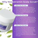Anti Fungal Scrub for Men & Women | Anti Dandruff, Medicated, Folliculitis Scrub for Dry Scalp, Psoriasis, Ringworm | for Itchy, Flaky & Irritated Scalp Infinity Warehouse