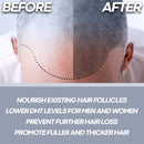 Foli-tonic DHT Blocker & Hair Loss Supplement - Hair Thinning Treatment & Promotes Healthy Thicker Hair Growth - with Saw Palmetto & Biotin for Men & Women - 60 Vegan Capsules Herbtonics