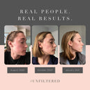 Averr Aglow Clear Skin Elixir, Face Mask Prevent Breakouts, Clear Acne & Oily Skin, Fade Scars Marks, Natural Skincare Solution, Reducer & Pores Cleanser Treatment, Natural Younger Looking Skin Averr Aglow Store