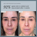 Alpha-H Multi-Peptide Face Serum - Firms & Plumps Fine Lines (30ml) | Peptide Blend Visibly Boosts Bounce & Elasticity, Lightweight, Fragrance-Free, Layers Under Moisturizer, Australian Made Infinity Warehouse