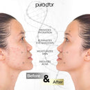 PURA D'OR Organic Sweet Almond Oil (16oz) Certified Organic 100% Pure & Natural Hexane Free Soothing Vitamin E Oil for Skin & Face, Facial Polish, Full Body, Massages, DIY Base (Packaging may vary) PURA D'OR