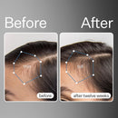 Act+Acre Cold Processed Stem Cell Scalp Serum - Promotes Thicker and Fuller-Looking Hair - Soothes and Hydrates the Scalp - Sulphate and Paraben Free - Aloe Vera for Improved Scalp Health - 1 fl oz. Infinity Warehouse