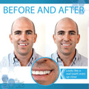 Instant Smile Complete Your Smile Tooth Replacement Kit with 3 Pack Fitting Beads Instant Smile