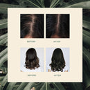 VEGAMOUR GRO Hair Serum for Thicker, Visibly Longer Hair - Vegan Hair Growth Serum Designed for Thinning Hair & Hair Loss VEGAMOUR