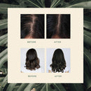 VEGAMOUR GRO Hair Serum for Thicker, Visibly Longer Hair - Vegan Hair Growth Serum Designed for Thinning Hair & Hair Loss VEGAMOUR