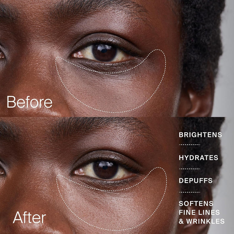 Timeline The Eye Cream - Anti-Aging Cream for Wrinkles, Dark Circles & Under Eye Bags with Urolithin A & Niacinamide (15 ml) Infinity Warehouse