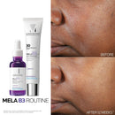 La Roche-Posay Mela B3 Serum, Dark Spot Corrector With Anti-Aging Melasyl + 10% Niacinamide, Discoloration Correcting Serum for Sun Spots, Age Spots & Post-Acne Marks Infinity Warehouse