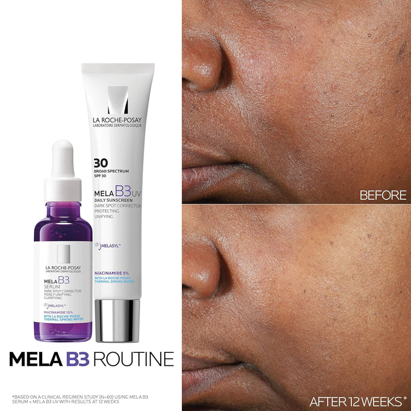 La Roche-Posay Mela B3 Serum, Dark Spot Corrector With Anti-Aging Melasyl + 10% Niacinamide, Discoloration Correcting Serum for Sun Spots, Age Spots & Post-Acne Marks Infinity Warehouse