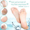 Foot Peel Mask - Vanilla Scent DERMORA