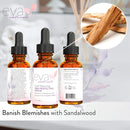 Skin Perfecting Serum – Rosehip Oil + Hyaluronic Acid Serum for Face – Naturally Hydrates, Fades Lines & Wrinkles, Repairs Damaged Skin, Diminishes Blemishes by Eva Naturals, 1 oz. Eva Naturals Store