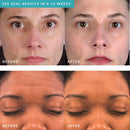 PMD Personal Microderm Pro - At-Home Microdermabrasion Machine with Kit for Face & Body - Exfoliating Crystals and Vacuum Suction for Fresh and Radiant Skin - High & Low Speed Options martinandmark.com