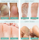 Foot Peel Mask - Vanilla Scent DERMORA