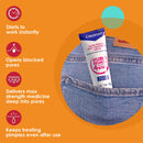 Acne Treatment Cream - Clearasil Rapid Rescue Spot Treatment Cream with Benzoyl Peroxide Acne Medication for Acne Relief in as fast as 4 hours, 1 Ounce Neutrogena