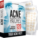 Acne Patches (120 Pack), Tea Tree Oil and Hydrocolloid Pimple Patches for Face, Zit Patch (3 Sizes), Blemish Patches, Acne Dots, Pimple Stickers, 100% All Natural Acne Patch and Pimple Patch BASIC CONCEPTS
