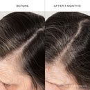 ZENAGEN Densifying Hair Serum for Fine + Thinning Hair | Boosts Hair Density, Strengthens & Nourishes Hair Follicles, Non-Greasy Water-Based Formula, Plant-Based, Vegan, All Hair Types Infinity Warehouse
