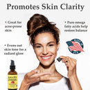 PURA D'OR Organic Evening Primrose Oil (4oz) 100% Pure Cold Pressed w/Natural Essential Fatty Acids & Antioxidant Rich - Moisturizes, Rejuvenates, Renews & Restores - Skin, Hair & Face PURA D'OR